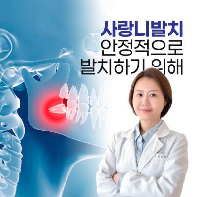 삼성역 사랑니발치를 찾는 분들